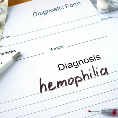 Understanding Replacement Therapy for Hemophilia