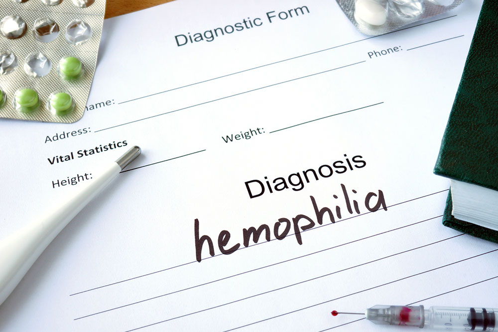 Understanding Replacement Therapy for Hemophilia