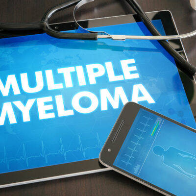 4 experimental treatments for multiple myeloma