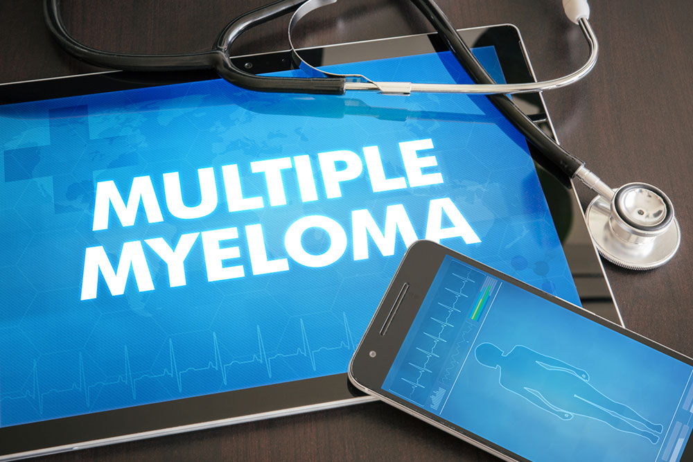 4 experimental treatments for multiple myeloma