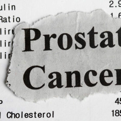 Prostate Cancer and its Risk Factors